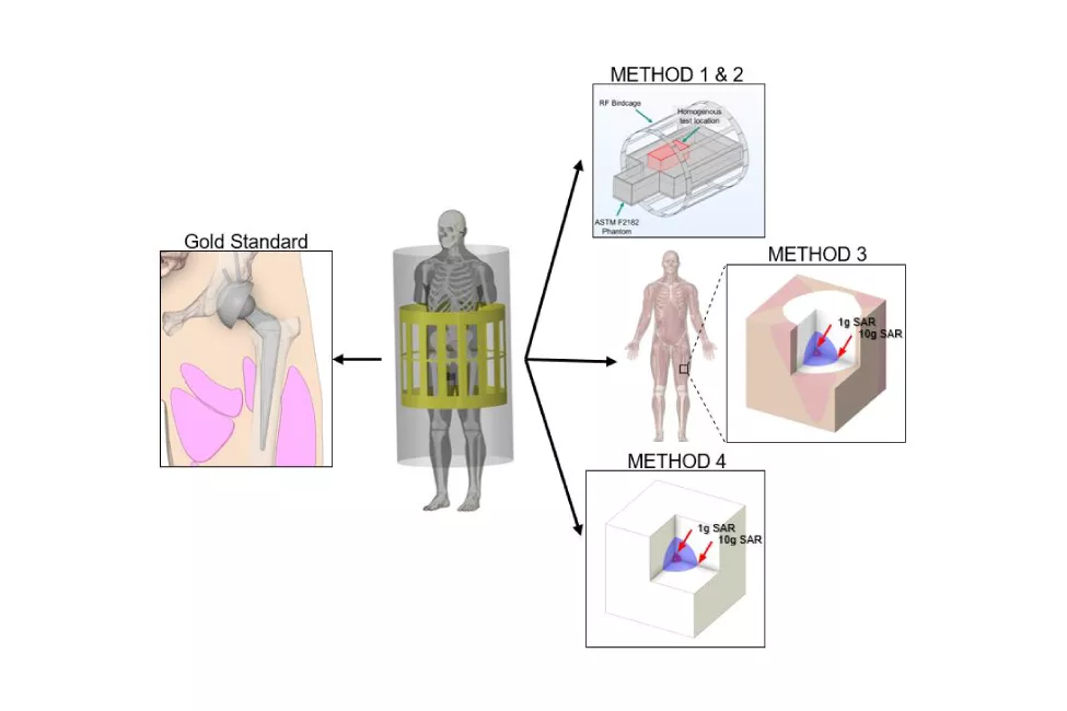 Three alternative depictions of computational methods for assessing heating of tissue around implanted medical devices during MRI.